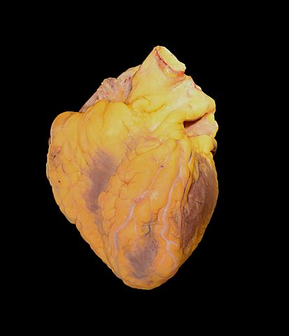 Photograph of a human heart. The Fact File - facts about heart