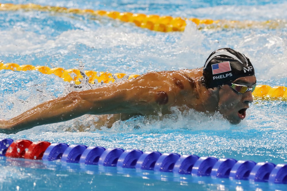 Michael Phelps with cup marks on his body. 